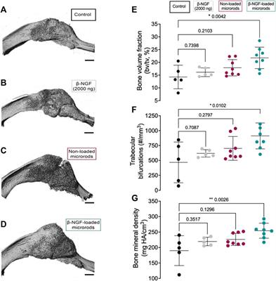 Encapsulation of β-NGF in injectable microrods for localized delivery accelerates endochondral fracture repair